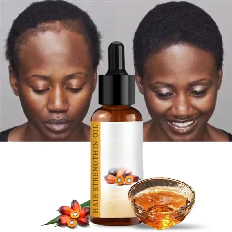 Lewedo Naturals huile de Batana croissance rapide des cheveux pour hommes femmes huile de Batana Pure nourrir les cheveux brillants soins capillaires