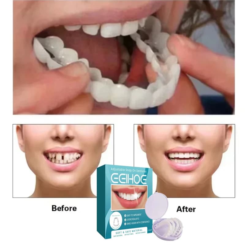 Prothèses dentaires ajustables blanchissantes, sourire parfait temporaire, fausses dents supérieures et inférieures, placages dentaires amovibles,