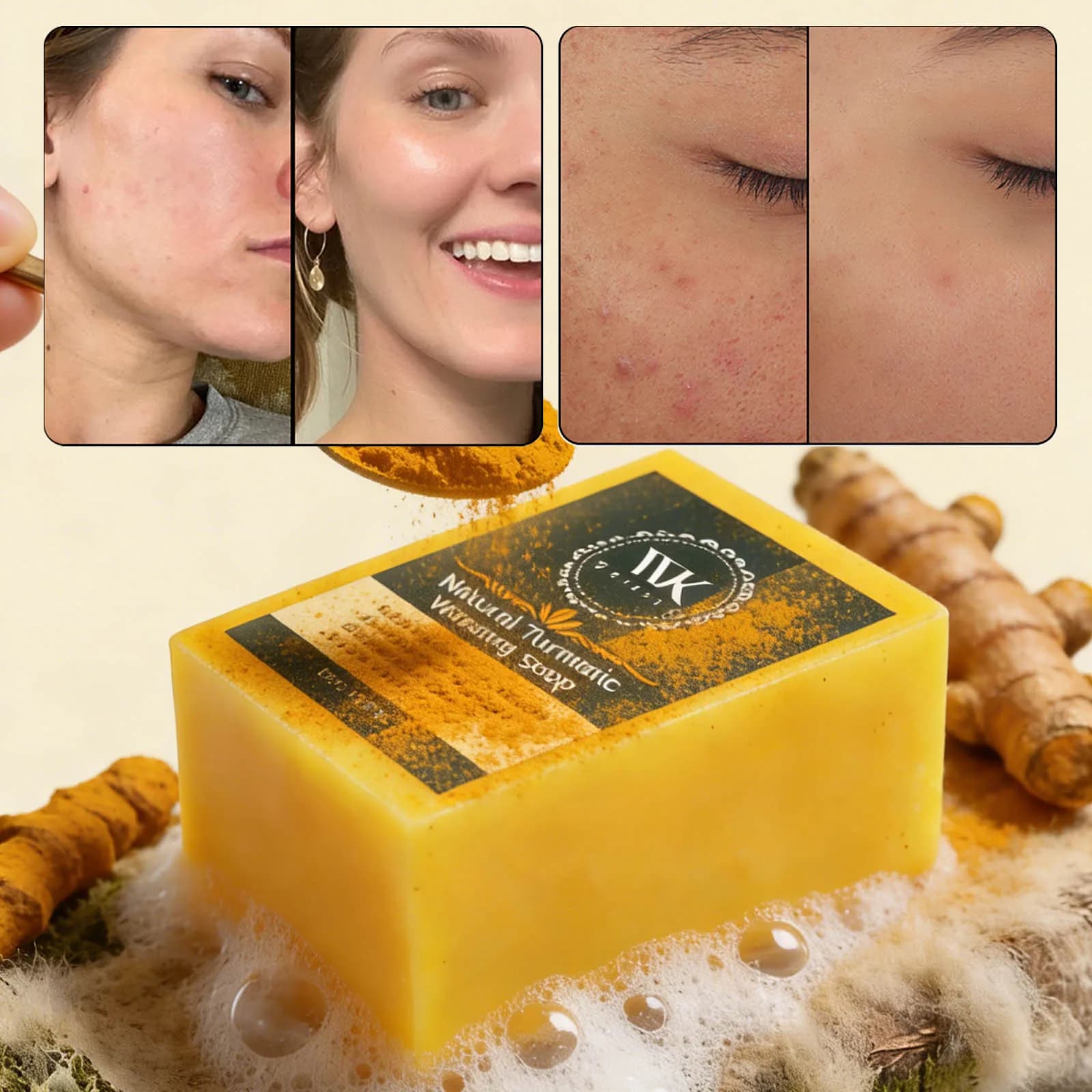 Savon éclaircissant au curcuma WK JALY, anti-acné, anti-taches brunes, avec acide hyaluronique, pour un teint uniforme, pour tous types de peau