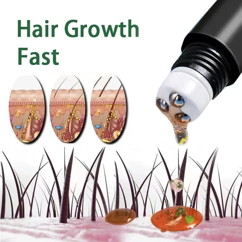 Huile de croissance rapide des cheveux à la biotine pour hommes, produits de soins, traitements de massage du cuir chevelu, anti-chute de cheveux,